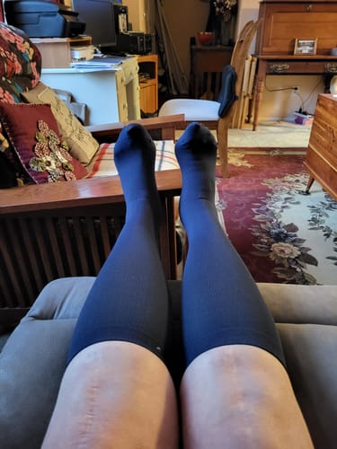 Customer photo review of Everstride™ Advanced Wide Compression Socks For Pain Relief